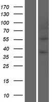 Perilipin-1(PLIN1) (NM_002666) Human Tagged ORF Clone