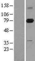 ASH2L (NM_004674) Human Tagged ORF Clone