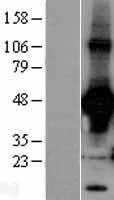 Rad9(RAD9A) (NM_004584) Human Tagged ORF Clone