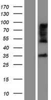 ZDHHC15 (NM_001146256) Human Tagged ORF Clone