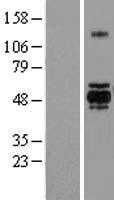 GSK3 alpha(GSK3A) (NM_019884) Human Tagged ORF Clone