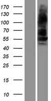 BMPR1B (NM_001203) Human Tagged ORF Clone