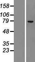 ZNF23 (NM_145911) Human Tagged ORF Clone