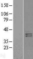 GPRC5B (NM_016235) Human Tagged ORF Clone
