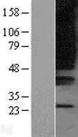 OXGR1 (NM_080818) Human Tagged ORF Clone