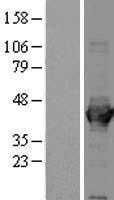Aldolase(ALDOA) (NM_000034) Human Tagged ORF Clone