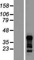RNF126 (NM_194460) Human Tagged ORF Clone