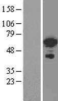 FOXC2 (NM_005251) Human Tagged ORF Clone