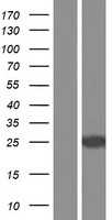 RAB3B(RAB3B) (NM_002867) Human Tagged ORF Clone