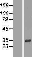 LRP15(LRRC3B) (NM_052953) Human Tagged ORF Clone