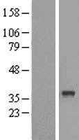 ABHD6 (NM_020676) Human Tagged ORF Clone
