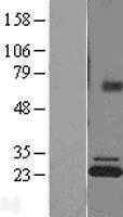 ATP5PB (NM_001688) Human Tagged ORF Clone