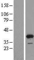 GRHPR (NM_012203) Human Tagged ORF Clone