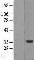 RDH11 (NM_016026) Human Tagged ORF Clone