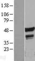FLI1 (NM_002017) Human Tagged ORF Clone