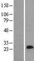 MLC1SA(MYL6B) (NM_002475) Human Tagged ORF Clone