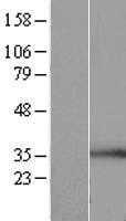 BUD23 (NM_017528) Human Tagged ORF Clone