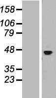 IL11RA (NM_004512) Human Tagged ORF Clone