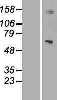 MRPP3(KIAA0391) (NM_014672) Human Tagged ORF Clone