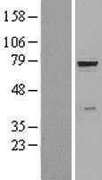 beta glucuronidase(GUSB) (NM_000181) Human Tagged ORF Clone