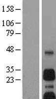 BNIP3 (NM_004052) Human Tagged ORF Clone