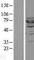 GSPT2 (NM_018094) Human Tagged ORF Clone