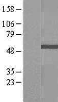 IFT81 (NM_031473) Human Tagged ORF Clone