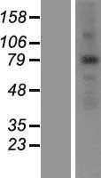 ANKZF1 (NM_018089) Human Tagged ORF Clone