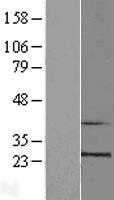 RPL10 (NM_006013) Human Tagged ORF Clone
