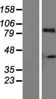 IL21 Receptor(IL21R) (NM_021798) Human Tagged ORF Clone