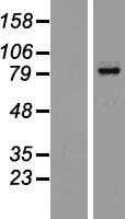 bcl 6(BCL6) (NM_001130845) Human Tagged ORF Clone