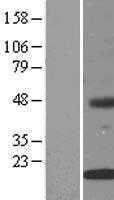 INSIG2 (NM_016133) Human Tagged ORF Clone