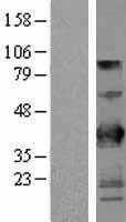 BTN3A2 (NM_007047) Human Tagged ORF Clone