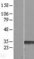 RND3 (NM_005168) Human Tagged ORF Clone