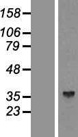 Aldolase C(ALDOC) (NM_005165) Human Tagged ORF Clone