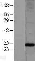 Apolipoprotein A I(APOA1) (NM_000039) Human Tagged ORF Clone