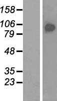 BRF1 (NM_001519) Human Tagged ORF Clone