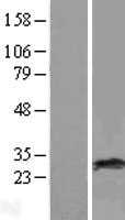 RAB38 (NM_022337) Human Tagged ORF Clone