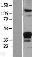 Fas Ligand(FASLG) (NM_000639) Human Tagged ORF Clone