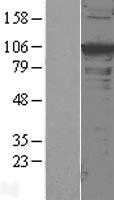 alpha Actinin(ACTN1) (NM_001102) Human Tagged ORF Clone