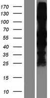 Retinal S antigen(SAG) (NM_000541) Human Tagged ORF Clone