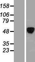 ALX4 (NM_021926) Human Tagged ORF Clone