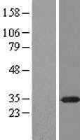 RPA34(RPA2) (NM_002946) Human Tagged ORF Clone