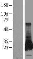 Glutathione S Transferase theta 2(GSTT2) (NM_000854) Human Tagged ORF Clone