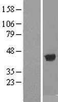 ADH1B (NM_000668) Human Tagged ORF Clone