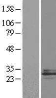 IL27 (NM_145659) Human Tagged ORF Clone