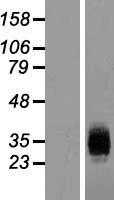 ICAM4 (NM_001544) Human Tagged ORF Clone