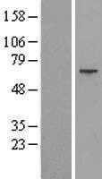 Alkaline Phosphatase(ALPP) (NM_001632) Human Tagged ORF Clone
