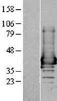 AKR1A1 (NM_006066) Human Tagged ORF Clone