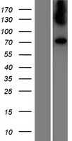 Galactosylceramidase(GALC) (NM_000153) Human Tagged ORF Clone